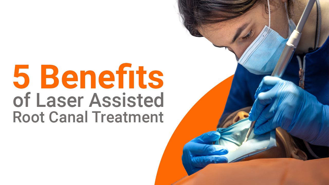 Advantages of Laser Assisted Root Canal Treatment