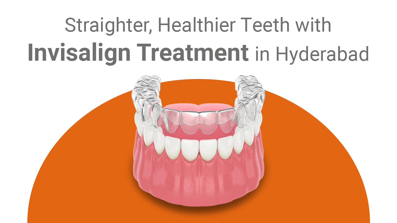 Benefits of Invisalign: Straighter and Healthier Teeth