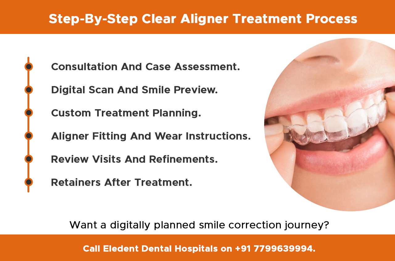 step-by-step-clear-aligner-treatment-process