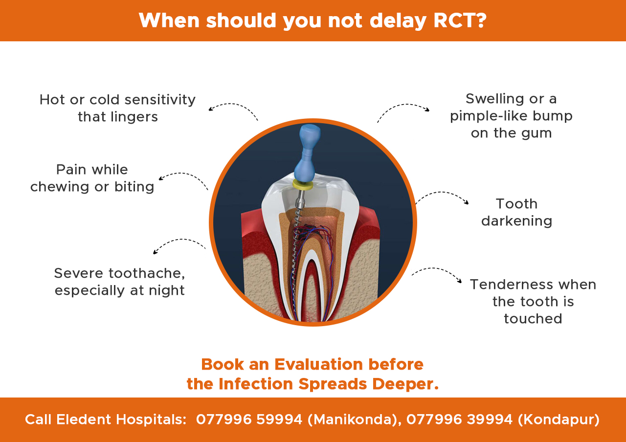 when-should-you-not-delay-RCT