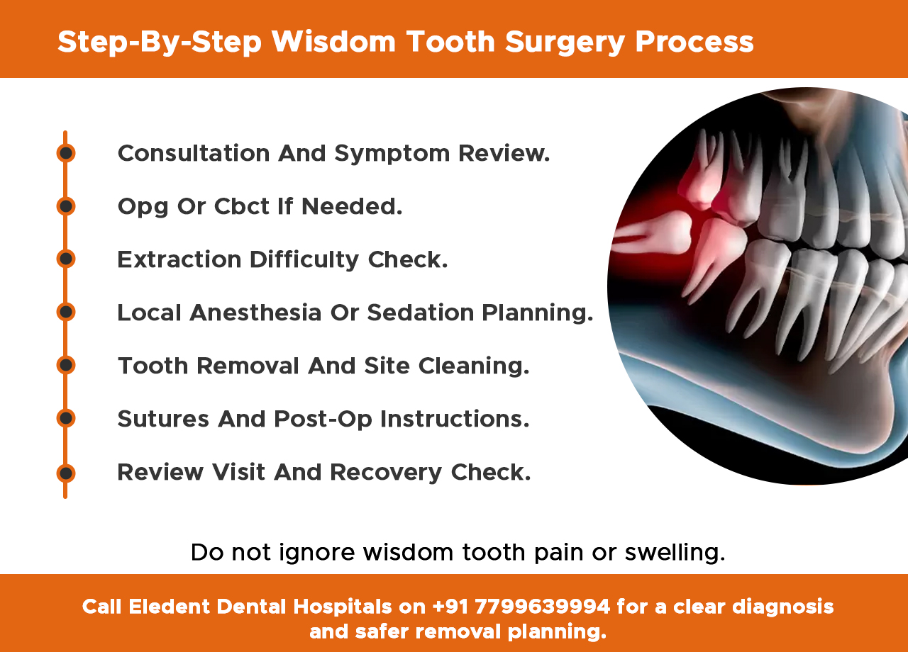 step-by-step-wisdom-tooth-surgery-process