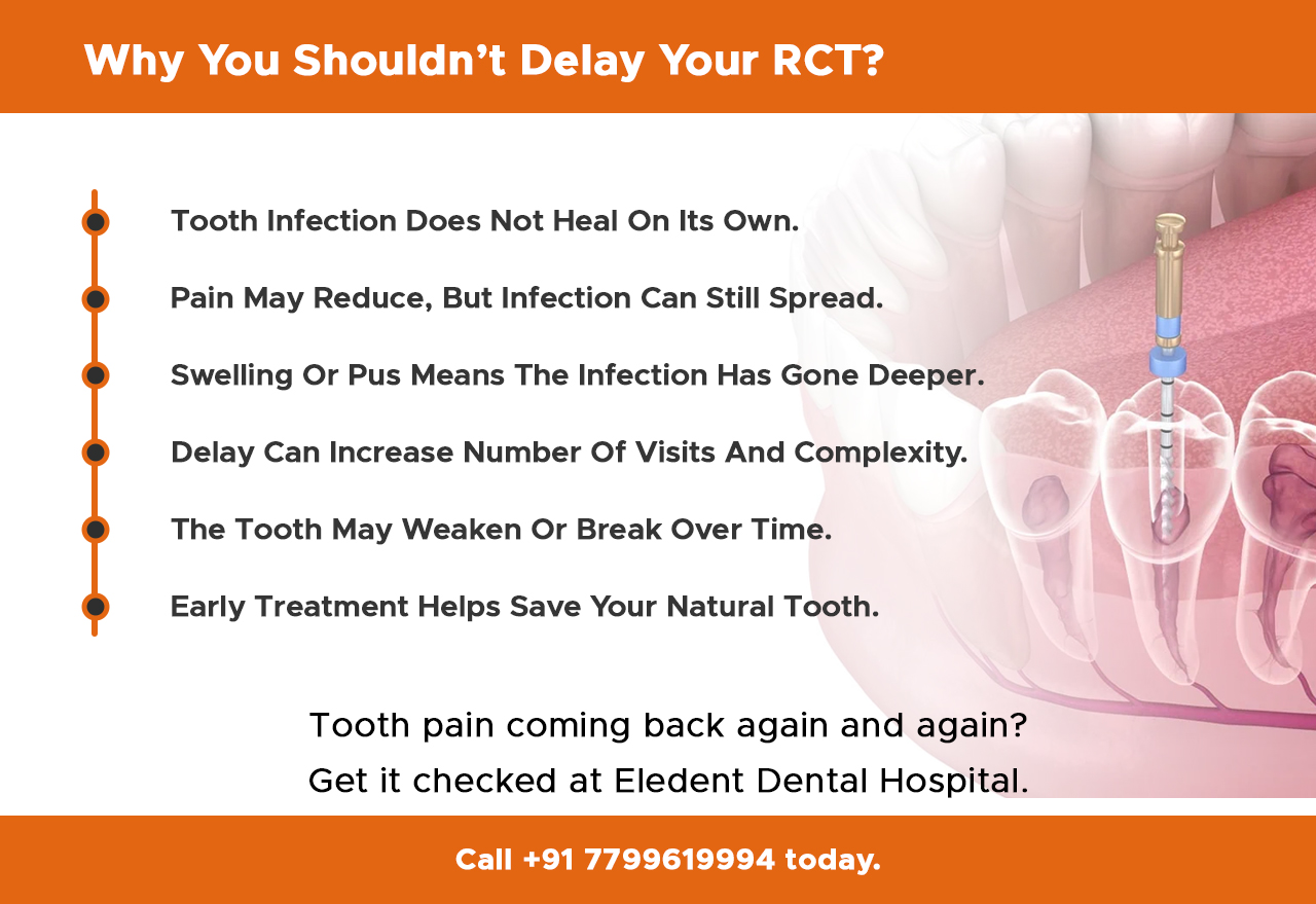 why-you-shouldn’t-delay-your-RCT