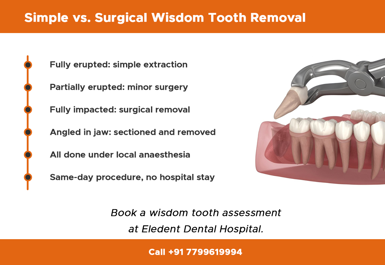 simple-vs.-surgical-wisdom-tooth-removal
